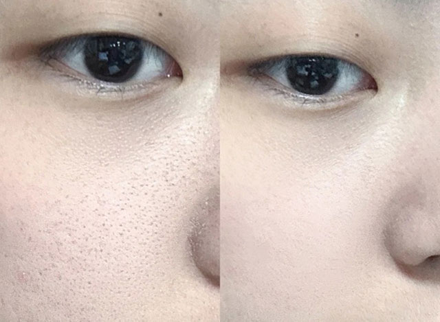 秋天也皮肤出油厉害？
