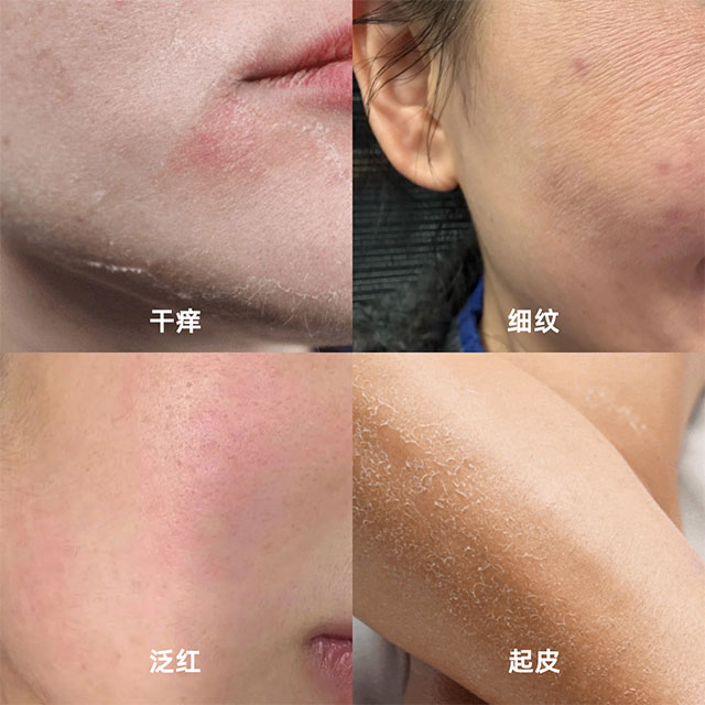 HFP牛油果面霜伴你滋润稳稳过冬 HFP牛油果面霜伴你滋润稳稳过冬