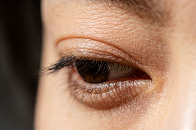 HFP冷玛吉眼油养出亮彩年轻眼