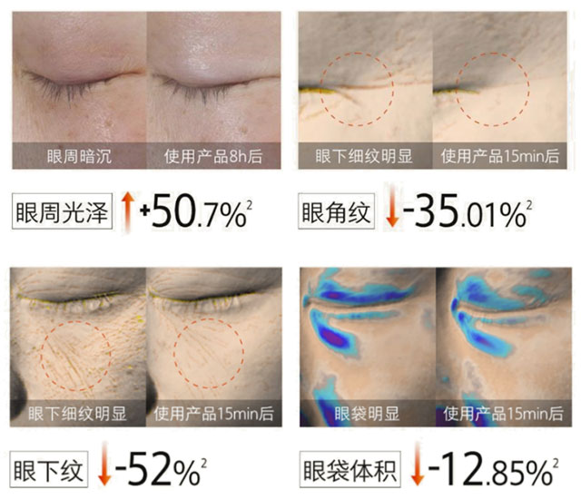 HFP冷玛吉眼油养出亮彩年轻眼