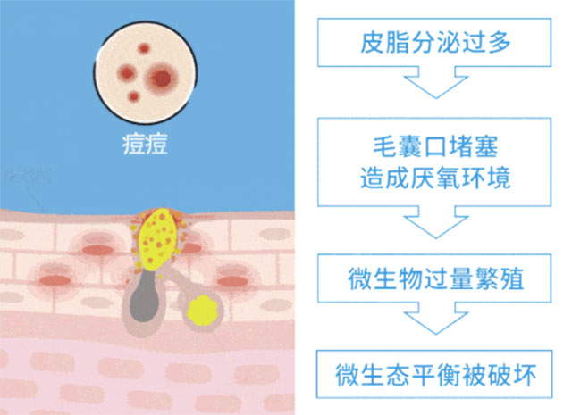 HFP果酸角质管理精华液
