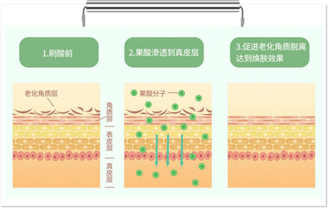 HFP果酸角质管理精华液