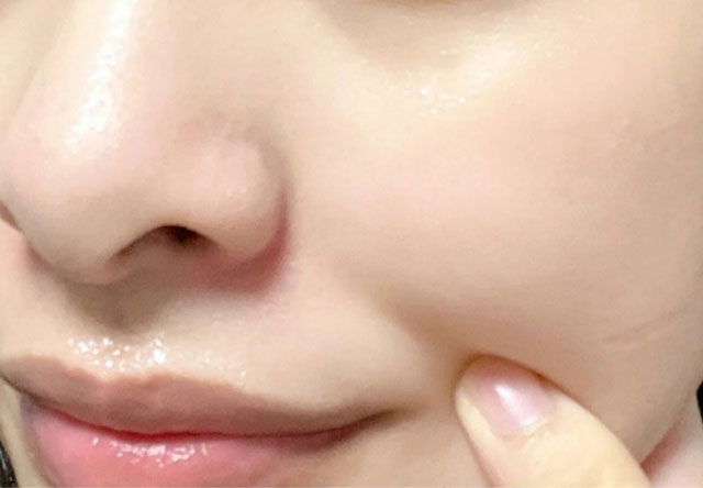 HFP果酸精粹水比面膜还管用? HFP果酸精粹水比面膜还管用?